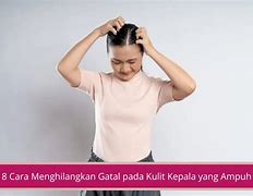 Cara Mengatasi Gatal Pada Kulit Kepala